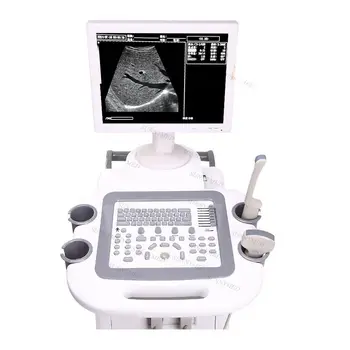 Kolica SY-A020, ultrazvučni skener, 15-inčni monitor, Medicinske ultrazvučne opreme